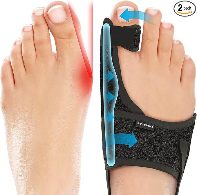 Bunion Splint